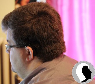 CI Kopf 2018 Erwachsen